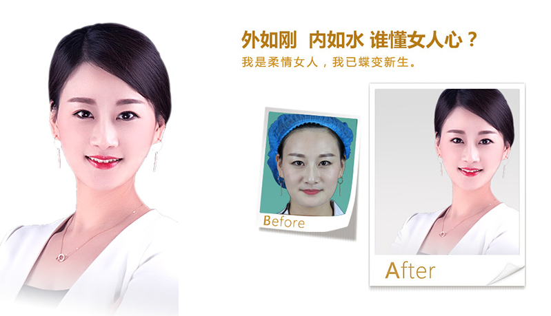 青岛V脸、线雕隆鼻